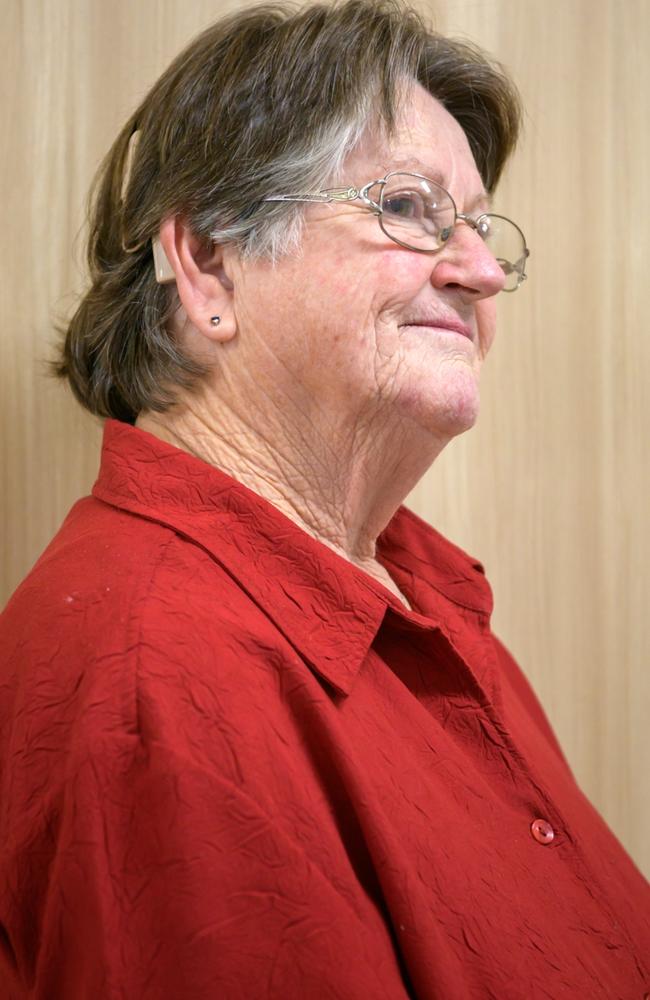 Susanne Ferguson had a cochlear implant inserted by Dr Jervis-Bardy at Lismore Base Hospital.