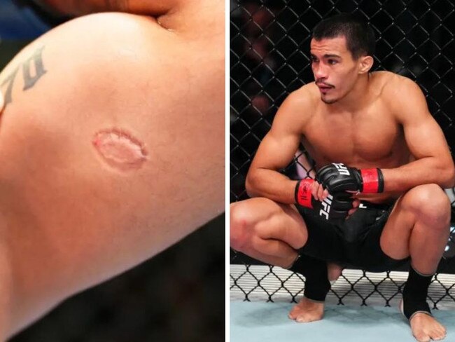 Igor Severino sacked over UFC bite. Photos: Zuffa LLC via Getty Images