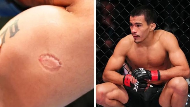 Igor Severino sacked over UFC bite. Photos: Zuffa LLC via Getty Images