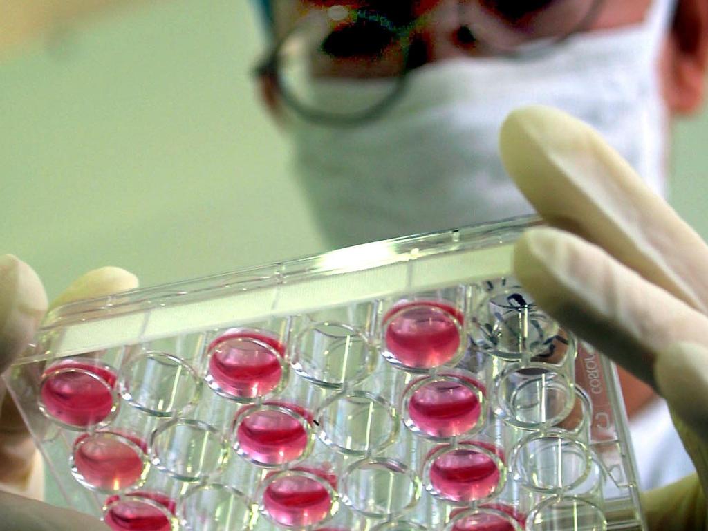 A Chinese medical researcher tests the SARS virus at a hospital laboratory in Guangzhou, southern China, at the height of the epidemic in 2003. Picture: AFP