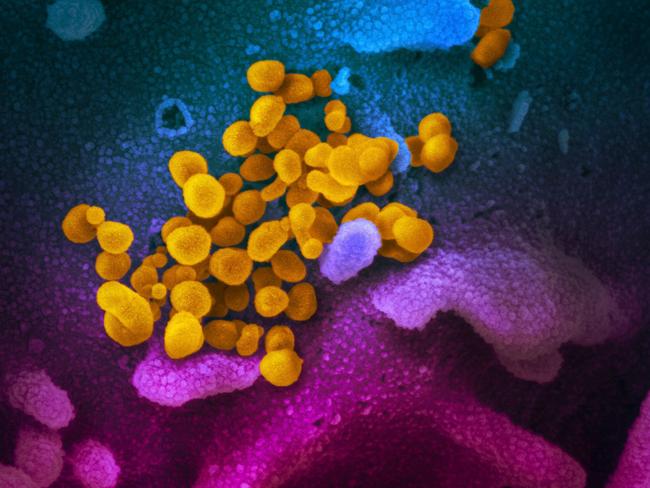 (FILES) In this file handout illustration image obtained February 27, 2020 courtesy of the National Institutes of Health taken with a scanning electron microscope  shows SARS-CoV-2 (yellow)âalso known as 2019-nCoV, the virus that causes COVID-19âisolated from a patient in the US, emerging from the surface of cells (blue/pink) cultured in the lab. - The US biotech firm Inovio reported preliminary but encouraging results June 30, 2020 from tests of an experimental coronavirus vaccine. Administered to 40 volunteers, it triggered an immune system response in 94 percent of those who completed the so-called phase one clinical trial, meaning they received two injections, four weeks apart.Inovio's vaccine, called INO-4800, is designed to inject DNA into a person so as to set off a specific immune system response against the SARS-CoV-2 virus. (Photo by Handout / National Institutes of Health / AFP) / RESTRICTED TO EDITORIAL USE - MANDATORY CREDIT "AFP PHOTO /NATIONAL INSTITUTES OF HEALTH/NIAID-RML/HANDOUT " - NO MARKETING - NO ADVERTISING CAMPAIGNS - DISTRIBUTED AS A SERVICE TO CLIENTS