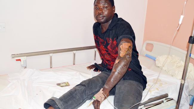 A victim of bomb blast at the crowded Emab Plaza, which Boko Haram insurgents have claimed responsibility for.