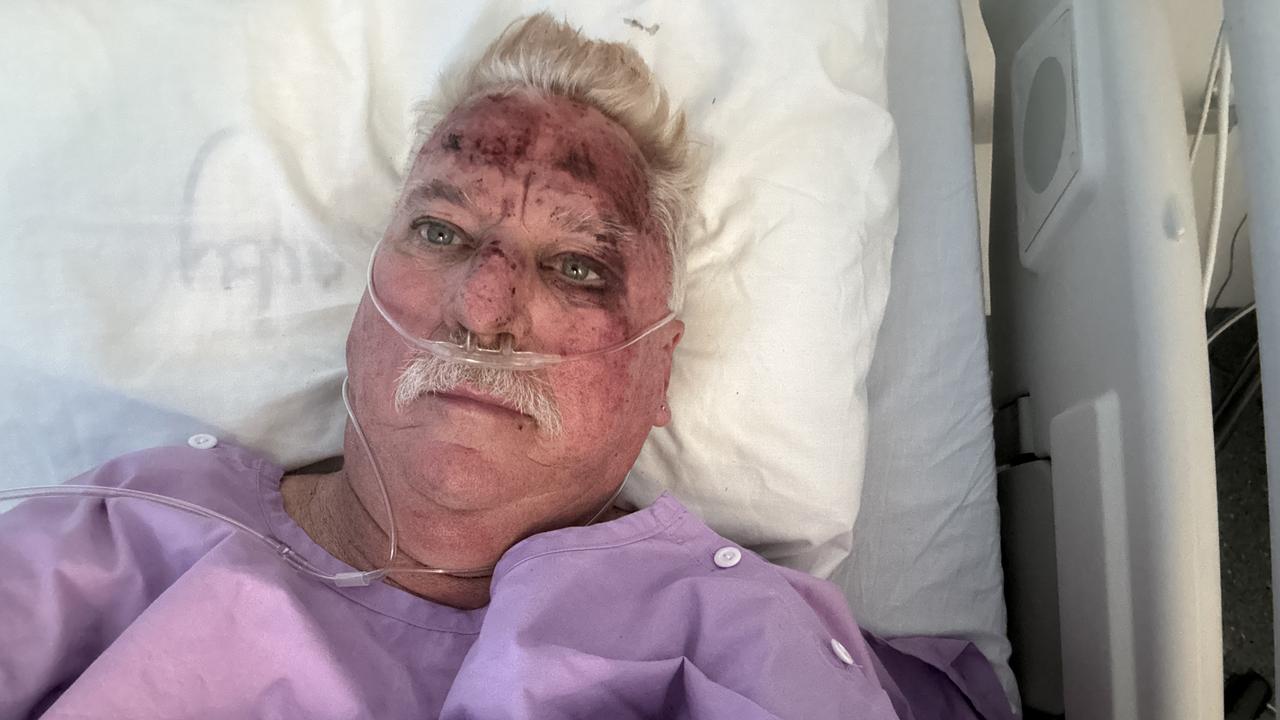 Mt Isa senior firefighter David McCrindle recovering in hospital.