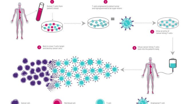 Scientists have discovered how to engineer the body’s own T-cells to better recognise and destroy tumour cells, Credit: The Parker institute