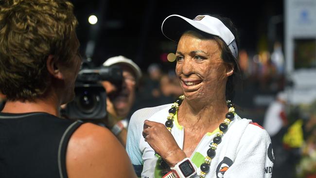 Bush fire survivor Turia Pitt, right, of Australia, gets a hug after finishing the Ironman World Championship Triathlon. Picture: Mark J. Terrill/AP