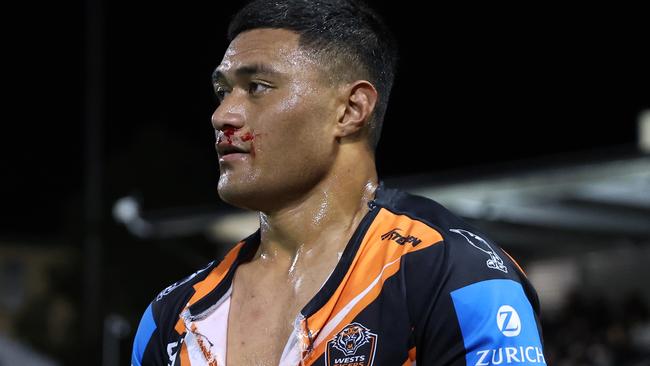 SYDNEY, AUSTRALIA - JULY 06: Stefano Utoikamanu of the Wests Tigers leaves the fiels with a bloody nose and ripped shirt during the round 18 NRL match between Wests Tigers and Melbourne Storm at Leichhardt Oval, on July 06, 2024, in Sydney, Australia. (Photo by Scott Gardiner/Getty Images)