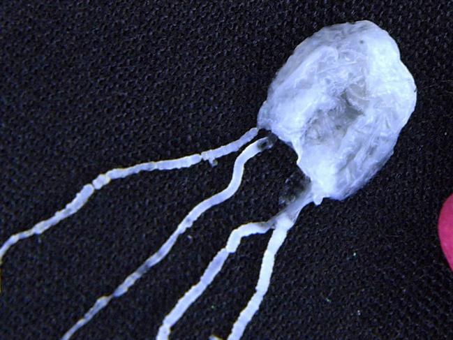 FILE - In this April 18, 2002 file photo taken at James Cook University in Cairns, Australia, a tiny but fully grown deadly Irukandji jellyfish lies next to match sticks for size comparison. A man was flown to a hospital intensive care unit after diving face-first into an extremely venomous, peanut-sized jellyfish in the waters off northeast Australia, officials said Friday, Dec. 4, 2009.  (AP Photo/Brian Cassey, File)