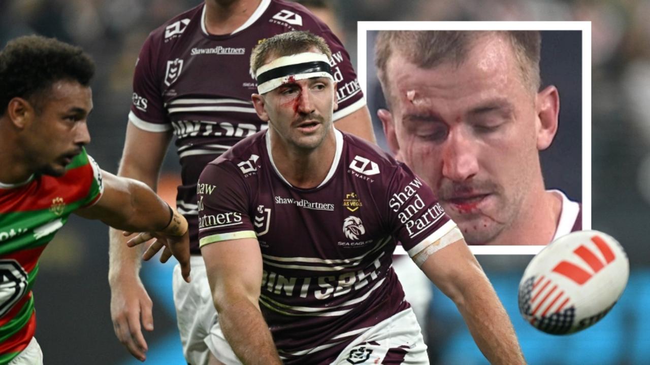 Bloody moment showed US NRL is ‘toughest game in the world’