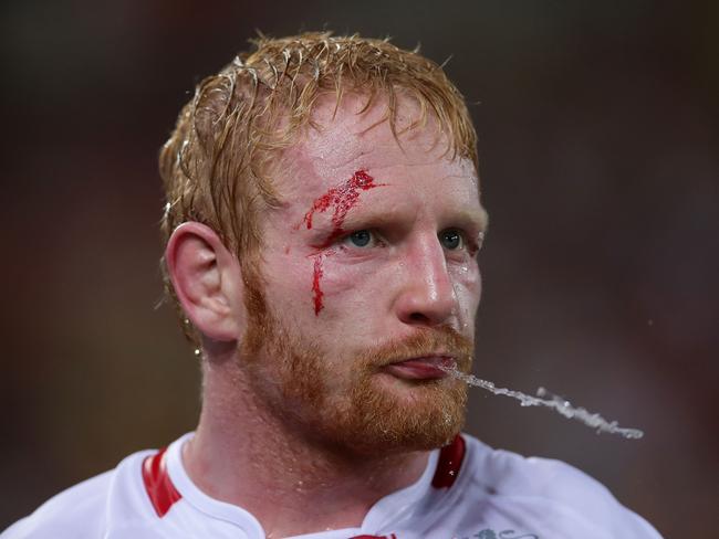 BRISBANE, AUSTRALIA - DECEMBER 02:  James Graham of England spits water during the 2017 Rugby League World Cup Final between the Australian Kangaroos and England at Suncorp Stadium on December 2, 2017 in Brisbane, Australia.  (Photo by Matt King/Getty Images)