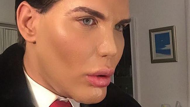 Rodrigo Alves plastic surgery Ken Doll. Picture: Instagram