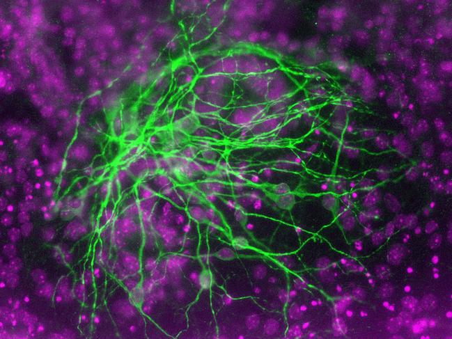 Microscopic image of embryonic tissues and cells used by scientists to explore stem cell research.Neuronal nebula.This photo depicts a bundle of neurons (stained green), formed in tissue culture from differentiated mouse embryonic stem cells. The nucleus (containing the genetic material) of each cell is stained purple. The ability to form mature brain cells such as neurons from embryonic stem cells has stimulated much excitement about the possibility of using stem cells to treat brain disease.