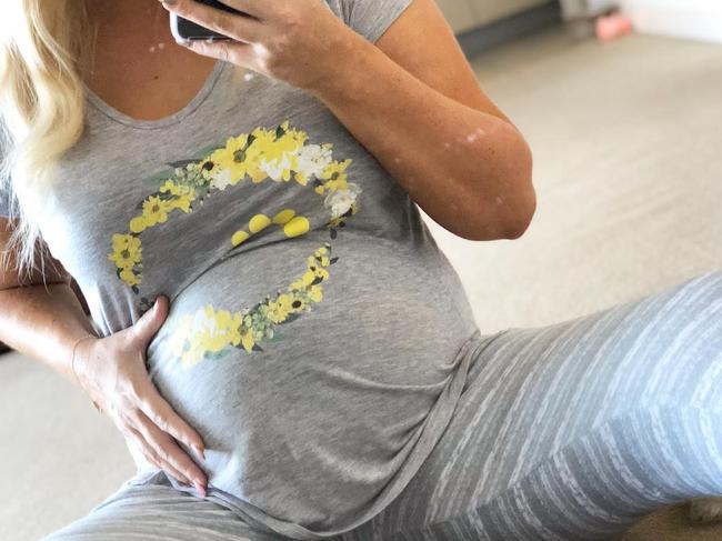 Mel Greig's 2018 photo that went viral, in which she showed her bloating belly.