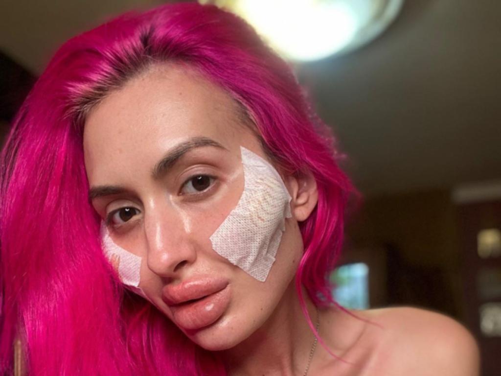 She says she has lost count of how many procedures she has had. Picture: Instagram