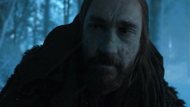 Uncle Benjen needs some really, really good moisturiser.