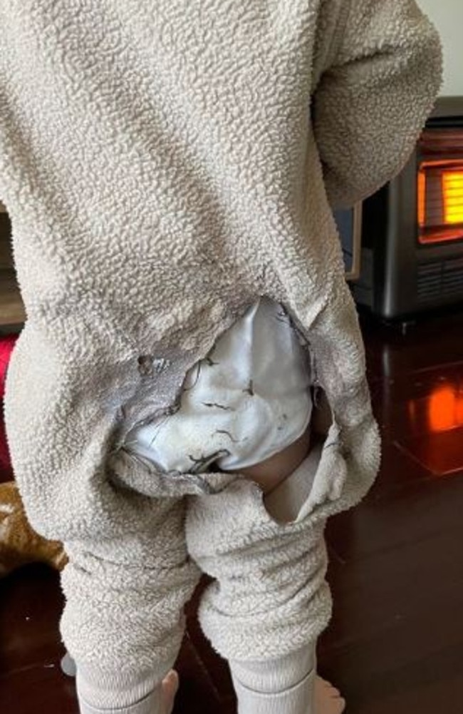 This little boy’s outfit caught fire within seconds of him being in front of the heater. Picture: Instagram/tinyheartseducation