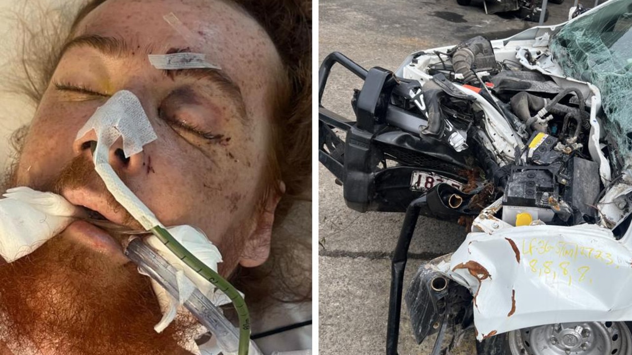 ‘Insides exploded’: Driver charged after friend’s face-shattering crash