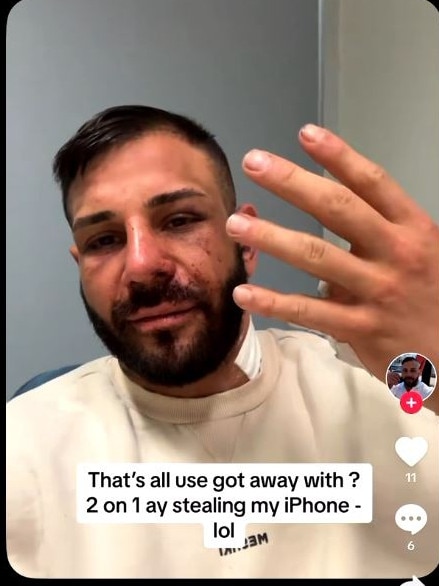 The victim posted photos of his injuries to TikTok.