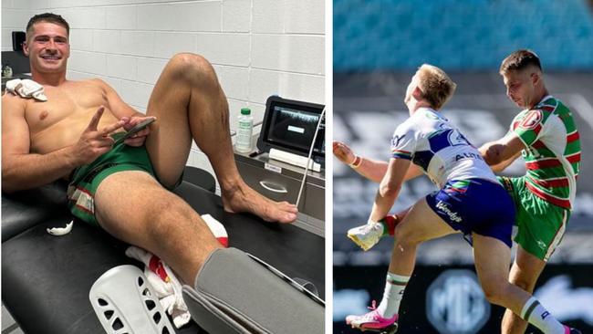 Lachlan Ilias broke his leg in the gruesome hit. Photo: Instagram and NRL images