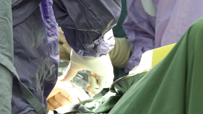 Surgeons perform an operation in the surgical room at Nambour Selangor hospital.Photo: Nicholas Falconer / Sunshine Coast Daily