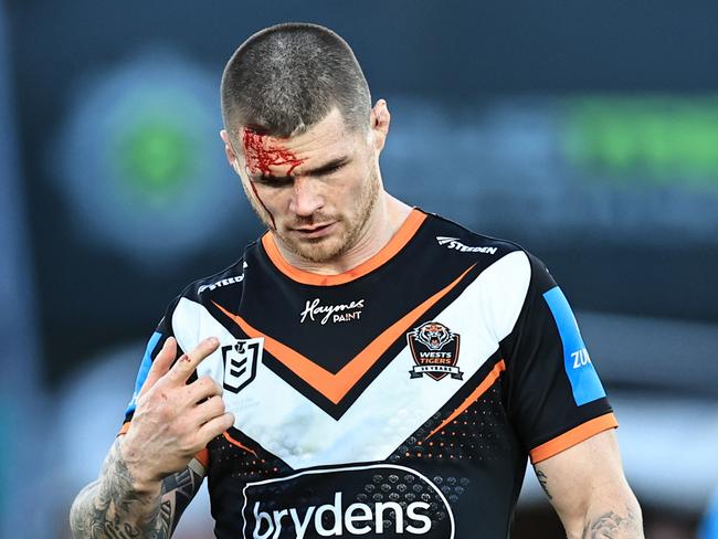 John Bateman has been released by Wests Tigers. Picture: Mark Evans/Getty Images