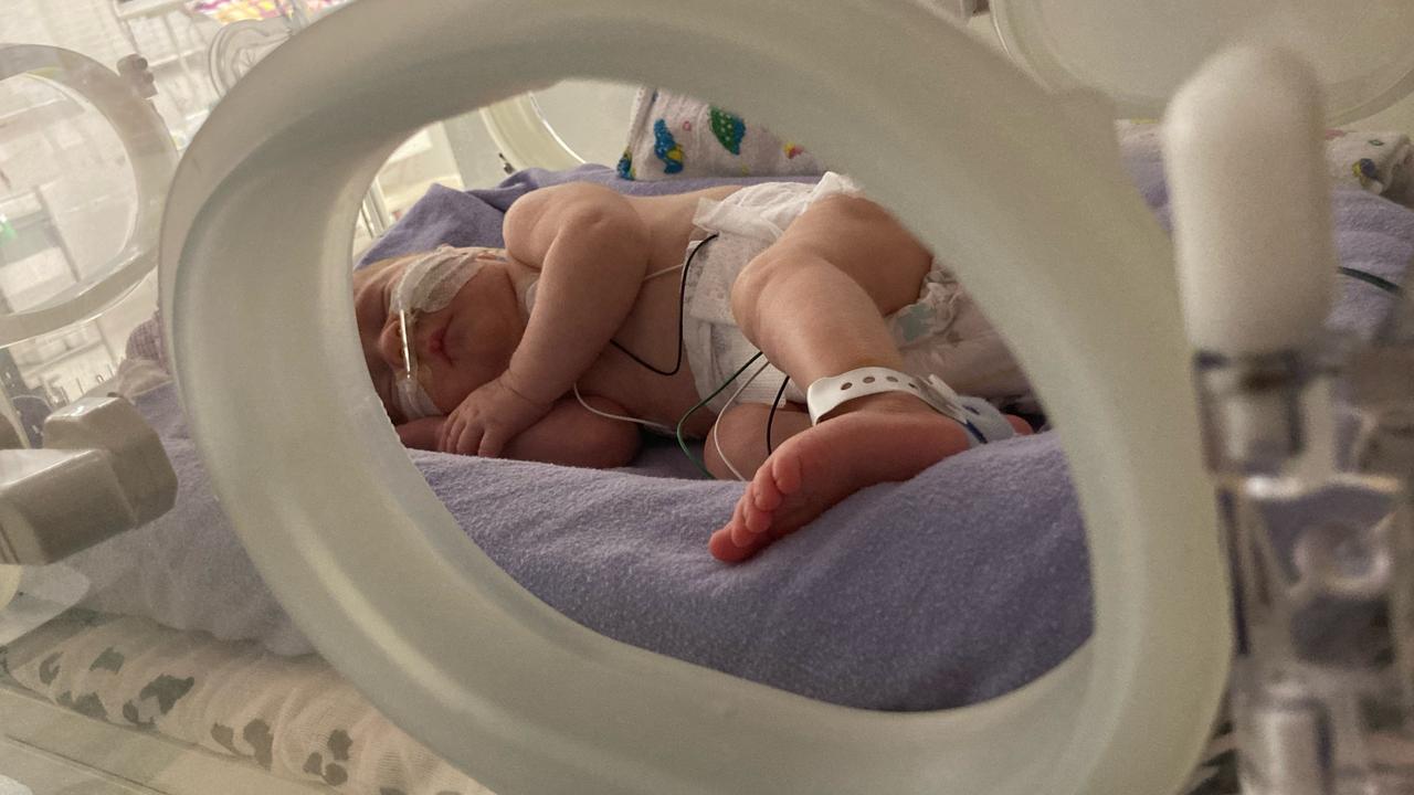 One of the twins during their stay in the special care nursery at the Buderim Private Hospital. Picture: Contributed