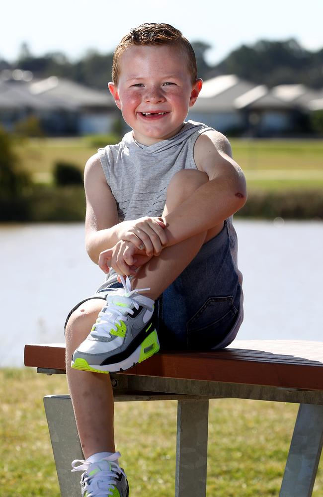 Chase Green is currently a happy, healthy kid in remission from his cancer. Picture: Toby Zerna