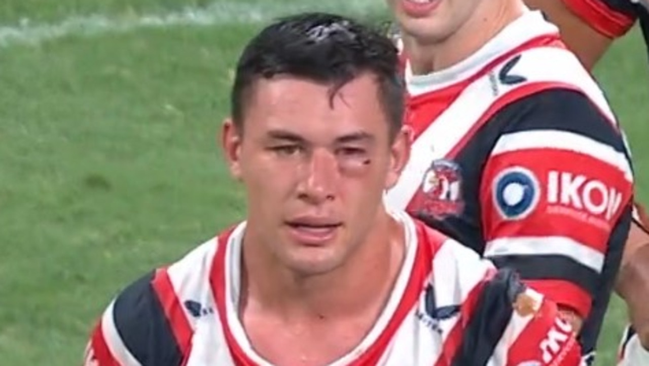 Manu was sin binned with the shiner. Photo: Fox Sports