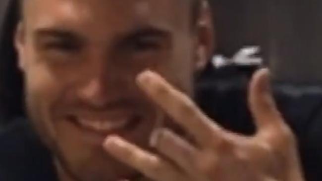 Angus Crichton shows off his missing finger.