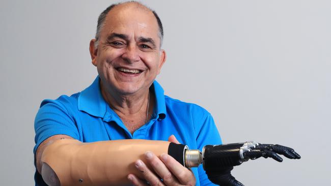 QLD_CP_NEWS_PROSTHETICS_19MAY22