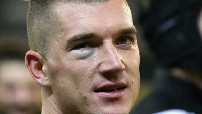 Dustin Martin was sporting a black eye after the clash with Collingwood. Picture: Wayne Ludbey