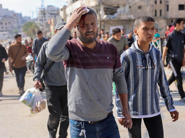 An injured Palestinian man holds a napkin to his head wound following more Israeli attacks in Gaza. Picture: AFP