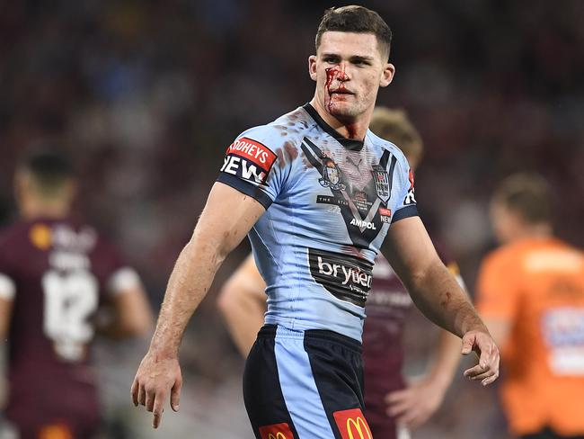 TOWNSVILLE, AUSTRALIA - JUNE 09:  Nathan Cleary of the Blues is seen with blood on his face after a cut during game one of the 2021 State of Origin series between the New South Wales Blues and the Queensland Maroons at Queensland Country Bank Stadium on June 09, 2021 in Townsville, Australia. (Photo by Ian Hitchcock/Getty Images)