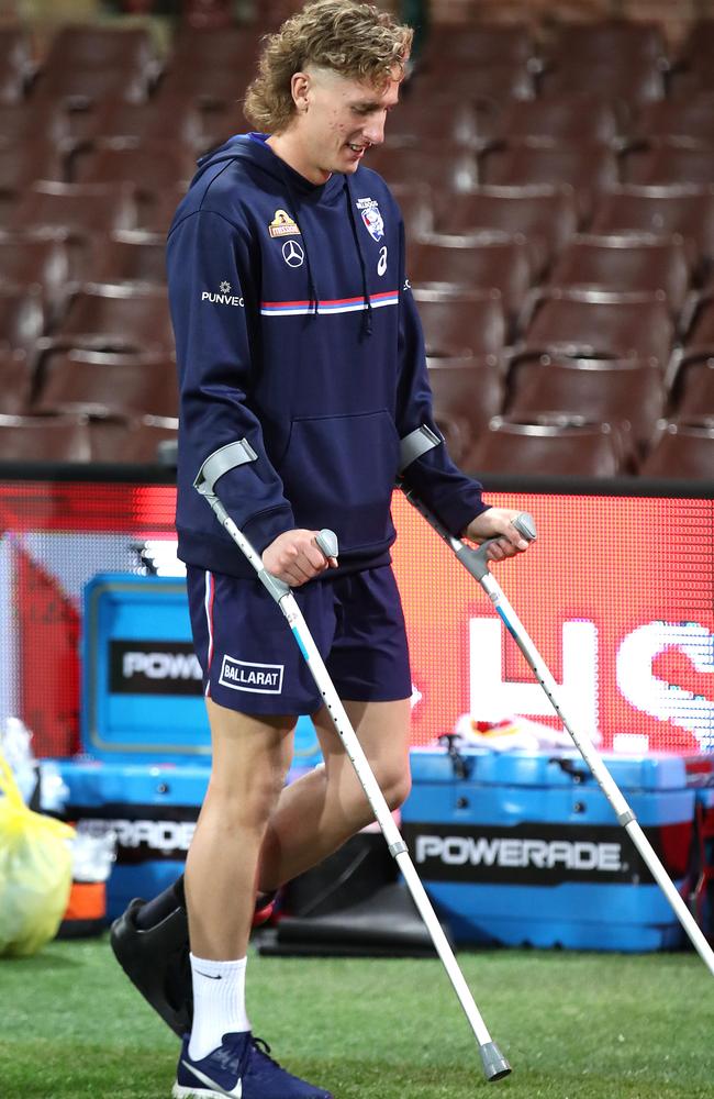 Aaron Naughton left the SCG on crutches. Picture: Phil Hillyard