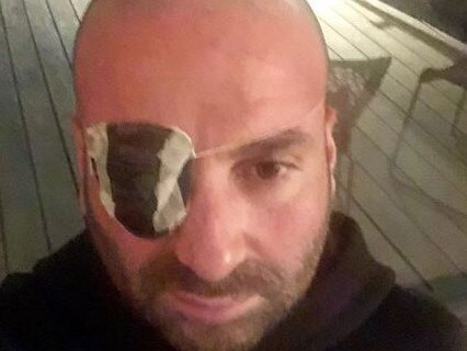 George Calombaris was hospitalised on Saturday for an eye injury. Picture: Instagram