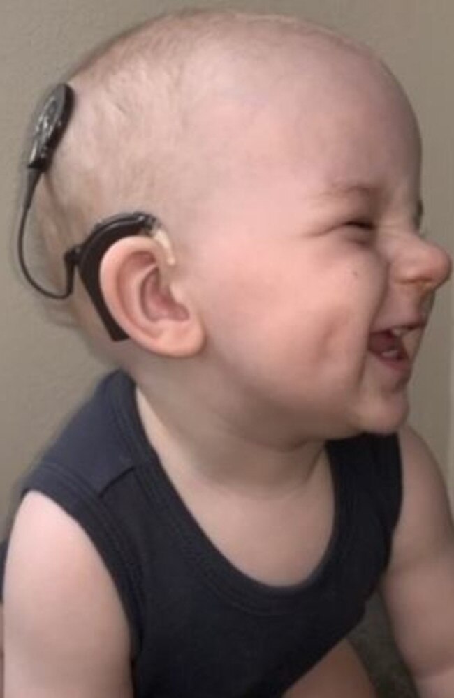 Wylder Lehfeldt of Chermside received a cochlear implant when he was nine months old.