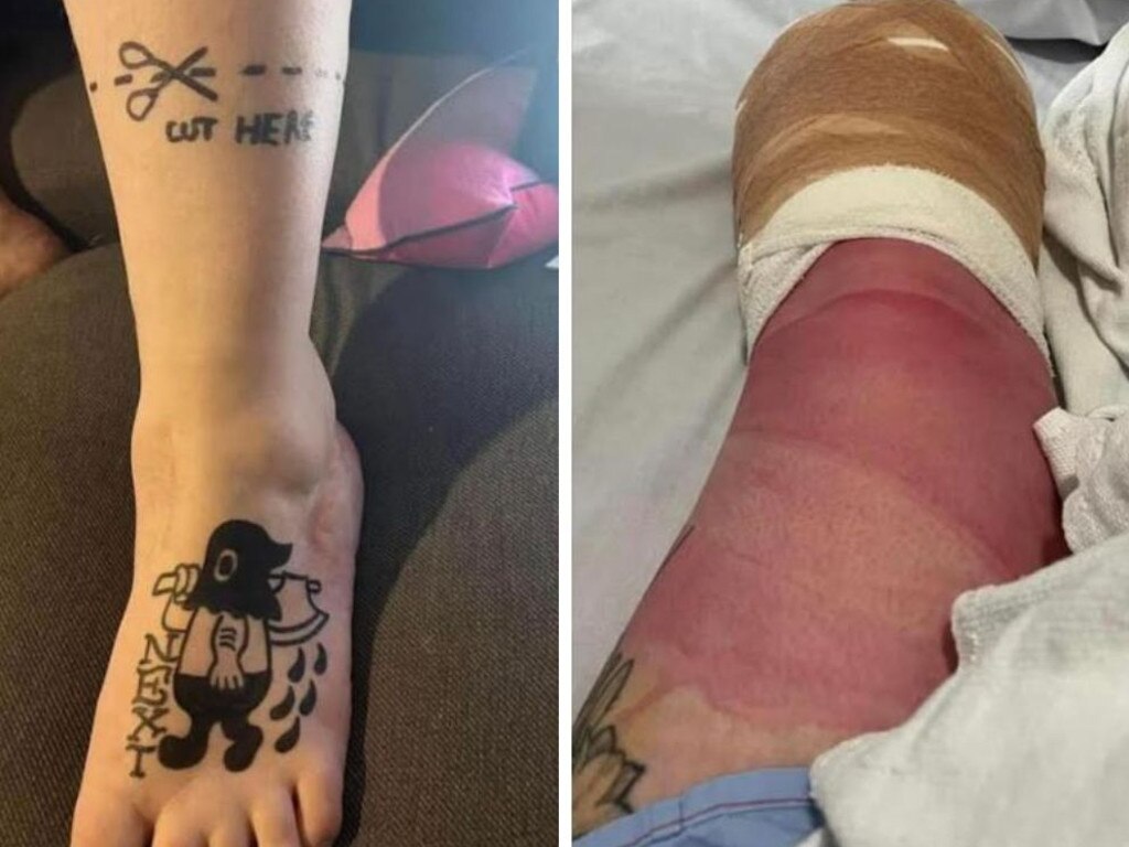 Her partner tattooed some funny ink onto her leg before it was amputated. Picture: Supplied