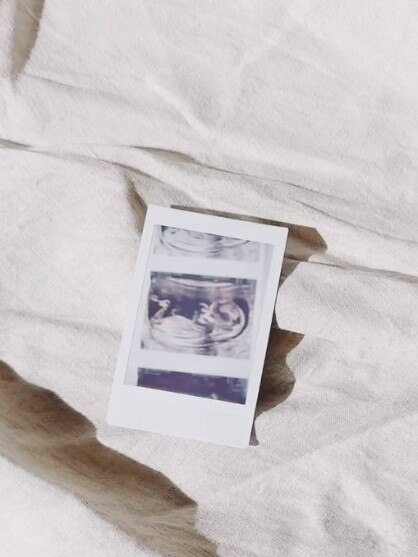 An ultrasound of the baby was posted by Rohan. Picture: Instagram