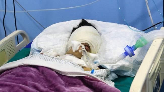 A child wounded during Israeli bombardment rests at a hospital in the southern Lebanese village of Saksaqiyeh on September 26, 2024. Israel flatly rejected on September 26 a push led by key backer the United States for a 21-day ceasefire in Lebanon, as it vowed to keep fighting Hezbollah militants "until victory". (Photo by Mahmoud ZAYYAT / AFP)