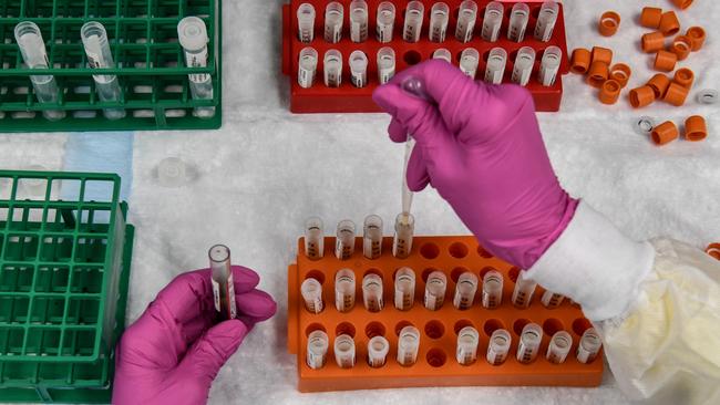 A lab technician sorts blood samples for a COVID-19 vaccine study in Florida. Picture: AFP