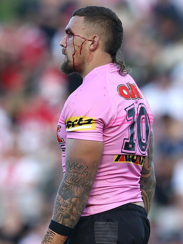 James Fisher-Harris is awaiting the results of scans on his shoulder. Picture: Jason McCawley/Getty Images