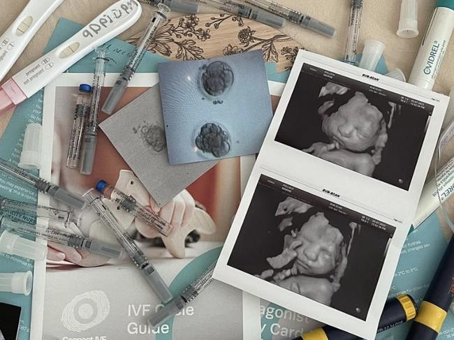Pictures from Marnie Pollock  after becoming pregnant through IVF.