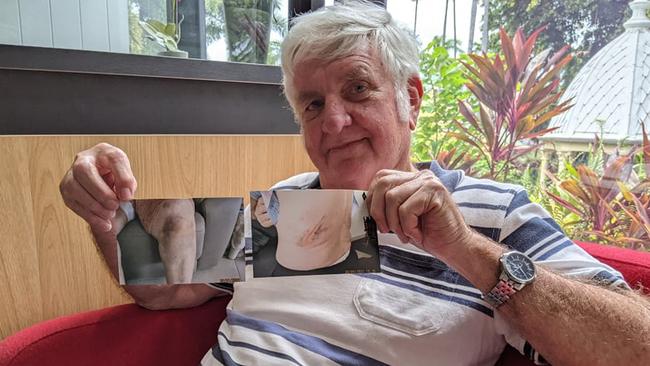 Graham Gransden's wife Suzanne was attacked twice in three months by a wallaby at Carlyle Gardens, leaving her bruised and battered both times.