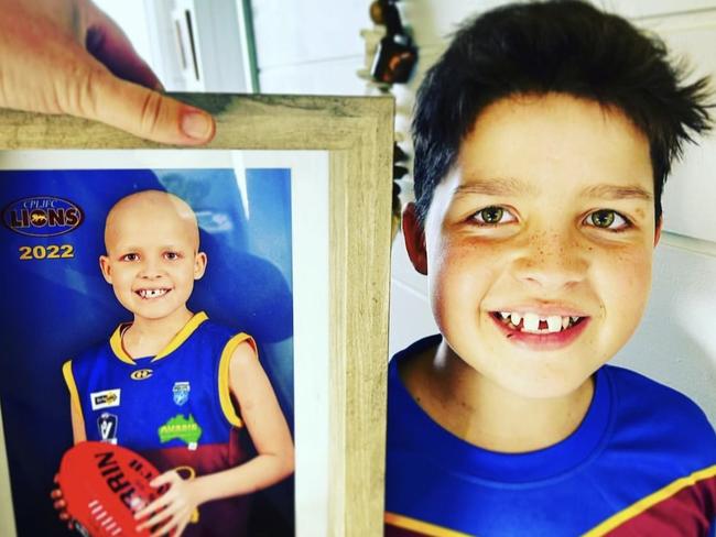 Doctors found a large tumour in Tommy's chest in September 2021.