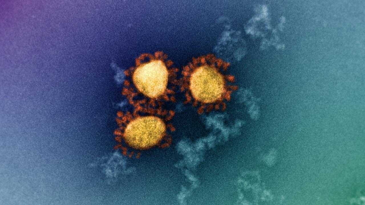 The omicron variant is predicted by some to end the pandemic. Picture: Dr Jason A. Roberts, Head, Electron Microscopy and Structural Virology, Doherty Institute