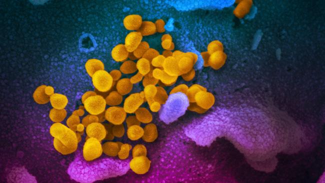 This US National Institutes of Health image shows SARS-CoV-2 (yellow) — also known as 2019-nCoV — the virus that causes COVID-19. Picture: AFP