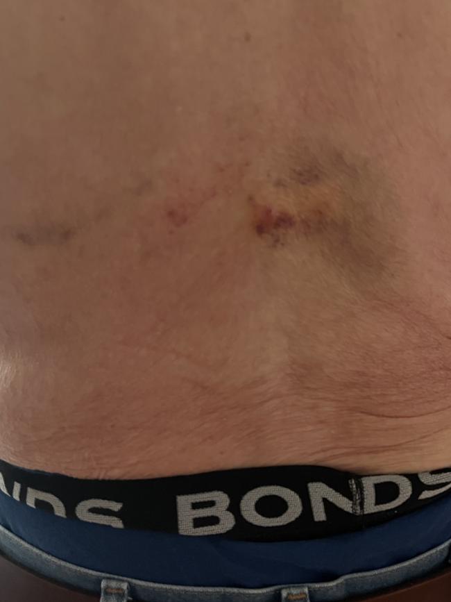 Mr Smith received a cut on his head and bruising to his back.