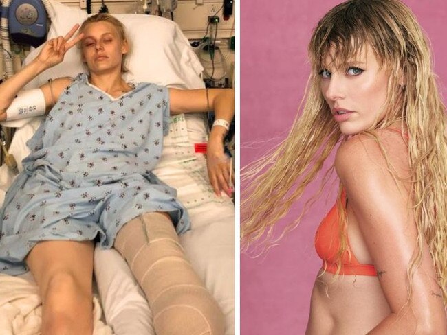 Lauren almost died from Toxic Shock Syndrome. Picture: Instagram