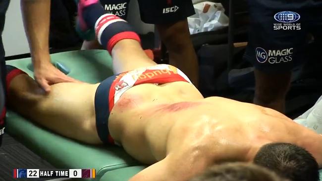 Cooper Cronk gets worked on in the sheds at half-time.