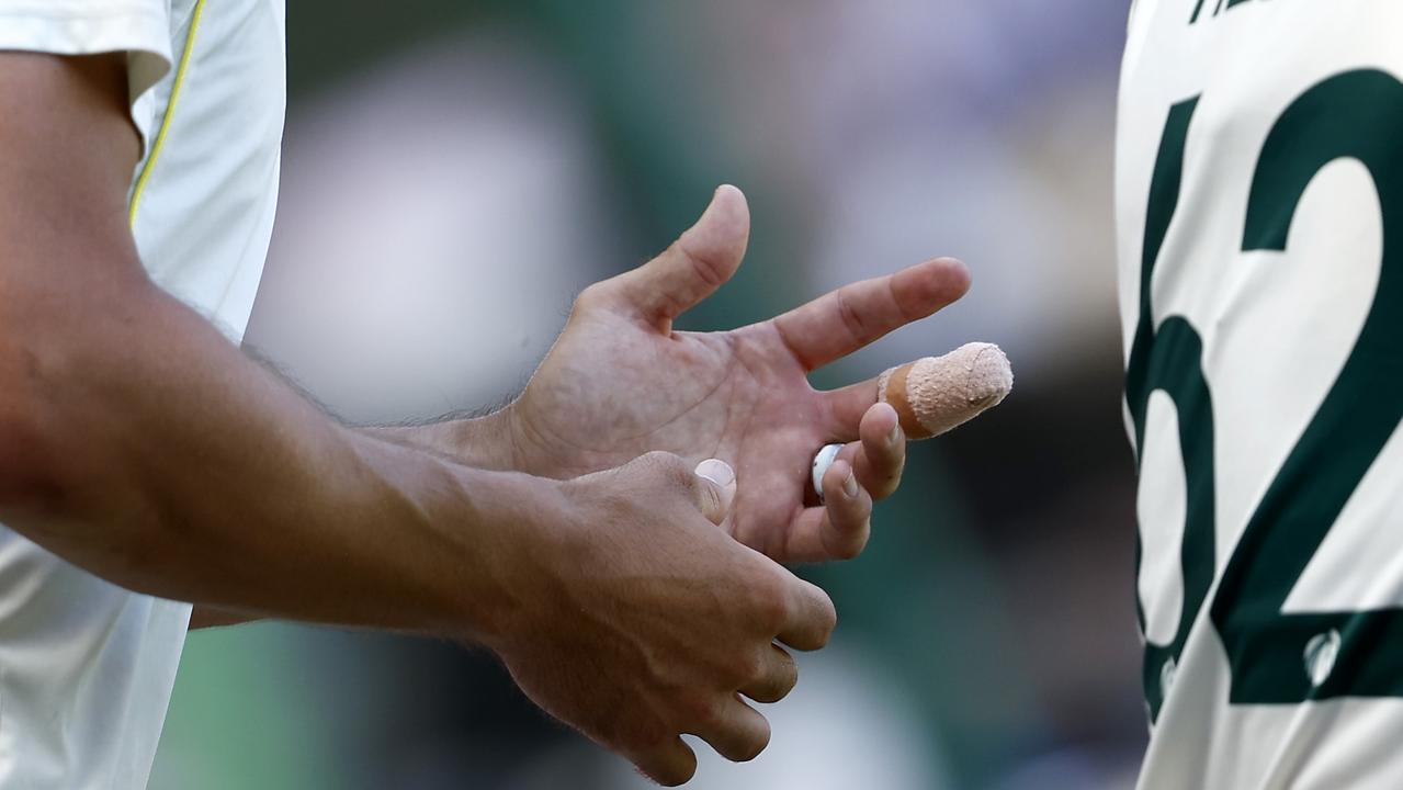 Mitchell Starc’s finger injury has ruled him out of the Sydney Test. Picture: Darrian Traynor/Getty Images