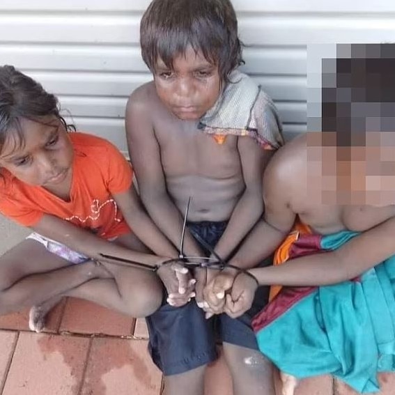 There has been a heated response to the footage of Aboriginal children bound with cable ties.